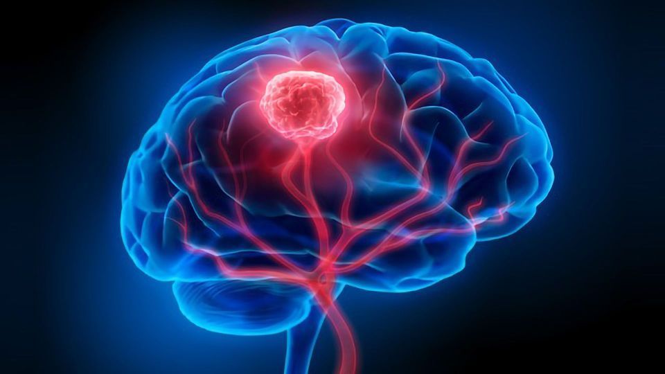 Brain Tumor Detection System